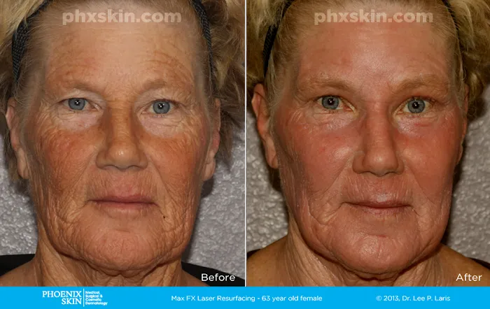 Phoenix Skin Medical Surgical Group Picture 8