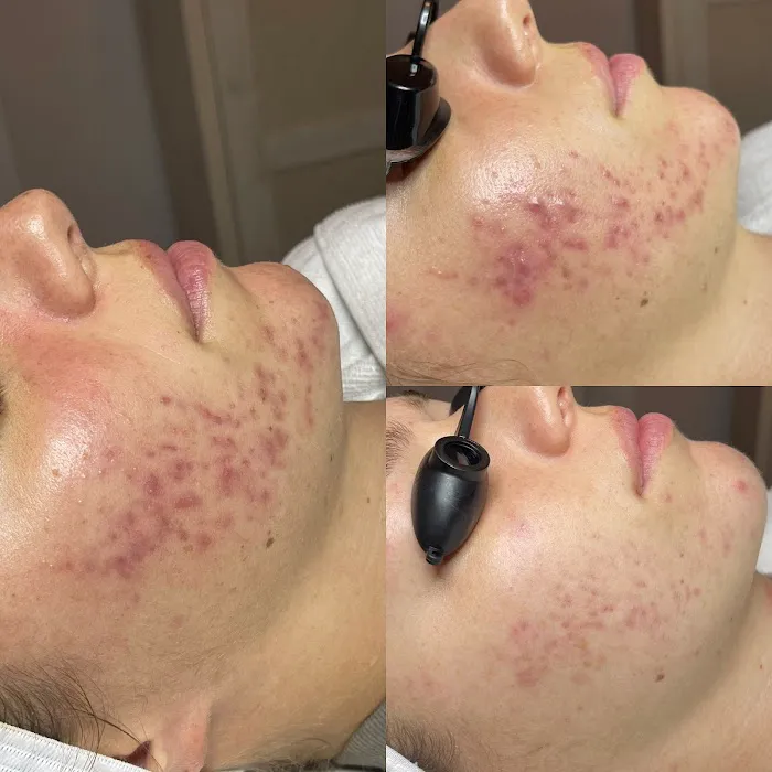 Slkderma Aesthetics Picture 5