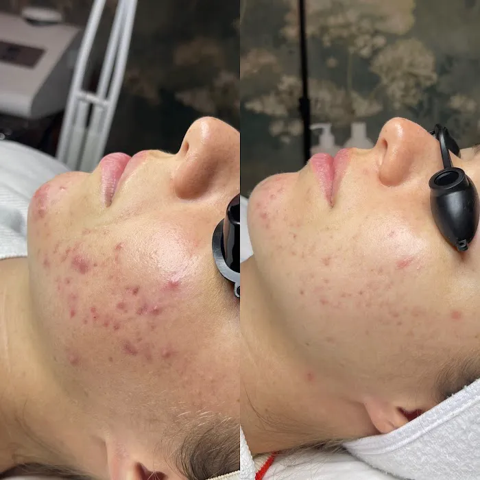 Slkderma Aesthetics Picture 4