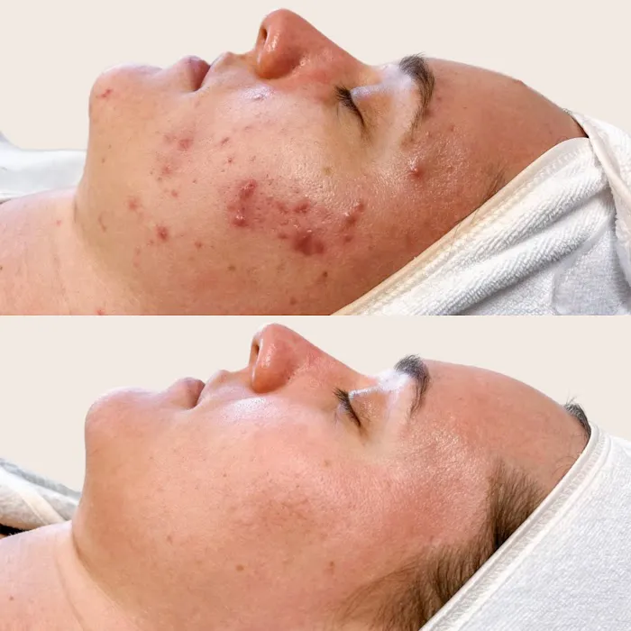 Skin Love Arizona Picture 6