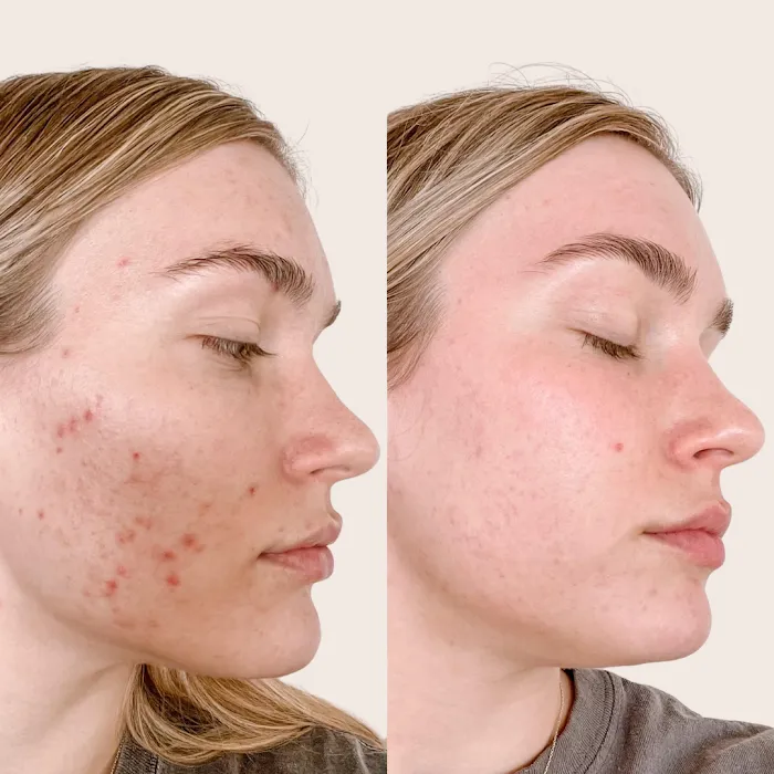 Skin Love Arizona Picture 9