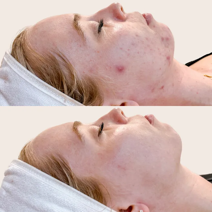 Skin Love Arizona Picture 8