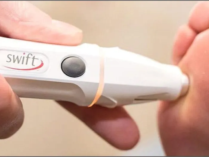 SWIFT Wart Removal Scottsdale Picture 6