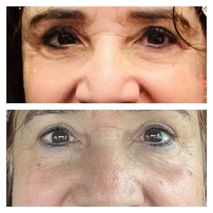 Love Your Skin Beauty Picture 7