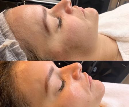 Beauty Gold Esthetics