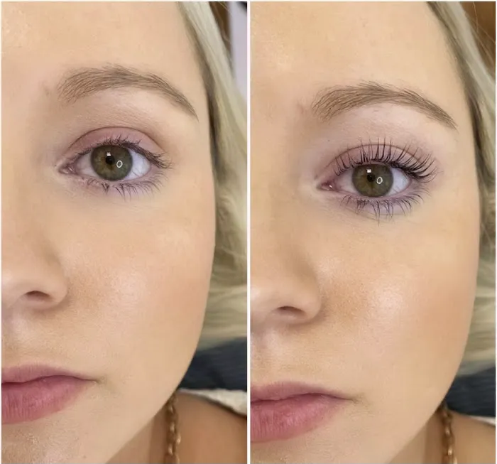 Beauty Gold Esthetics Picture 8