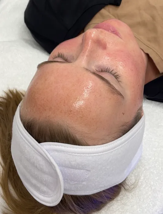 Beauty Gold Esthetics Picture 9