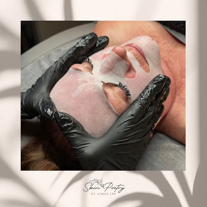 Skin Poetry Picture 4