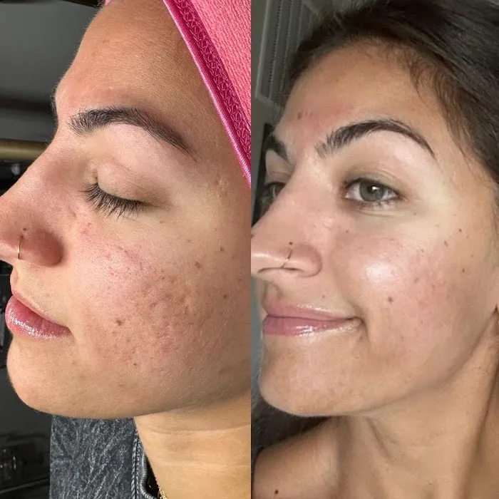 Meraki Beauty Bar Picture 6