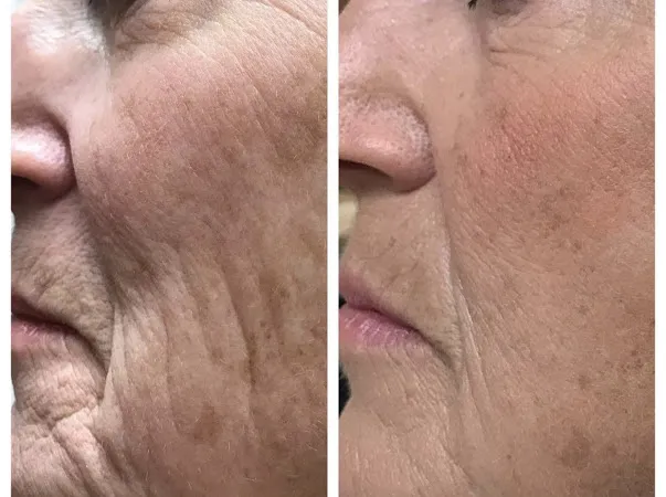 Meraki Beauty Bar Picture 3