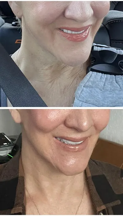 Meraki Beauty Bar Picture 4