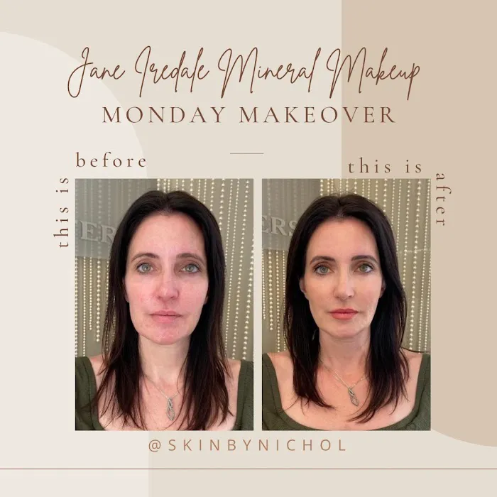 Skin by Nichol Picture 2