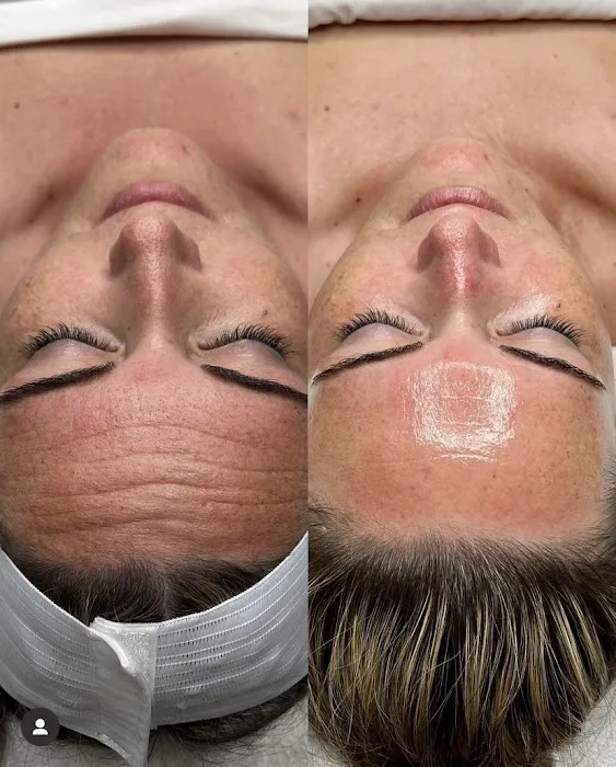 Skin by Nichol Picture 10