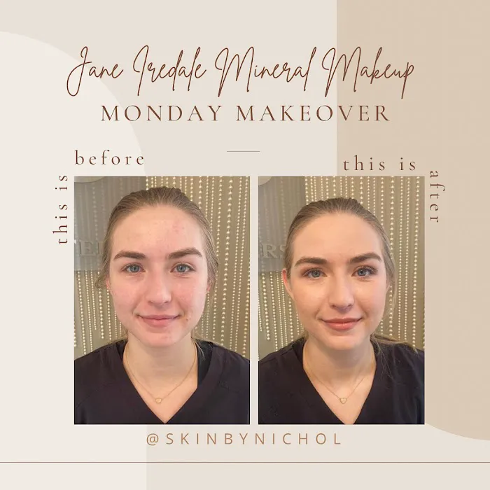 Skin by Nichol Picture 5