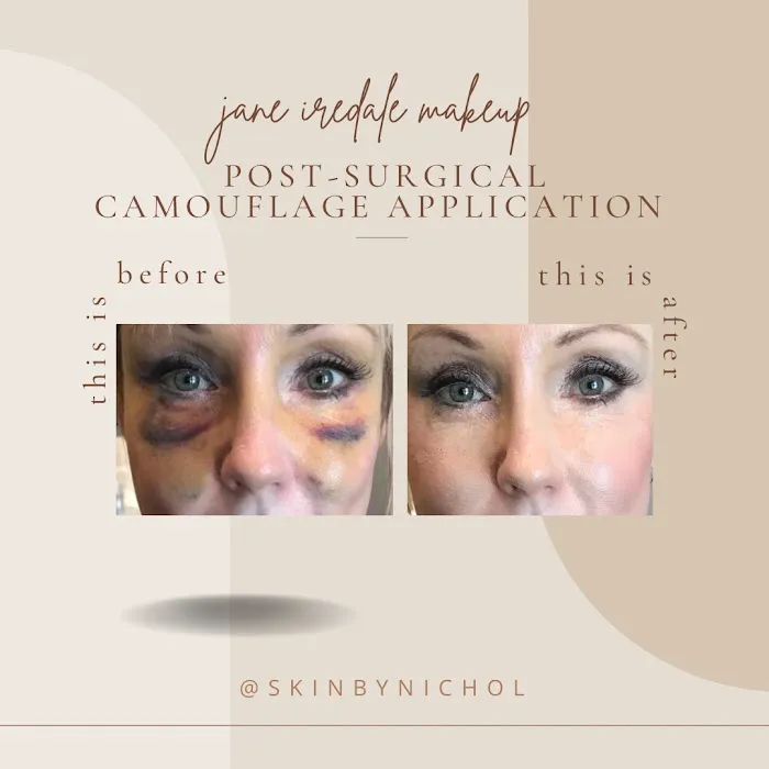 Skin by Nichol Picture 8