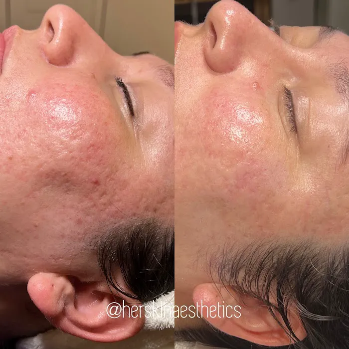 Herskin Aesthetics Picture 4