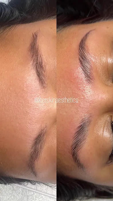 Herskin Aesthetics Picture 3