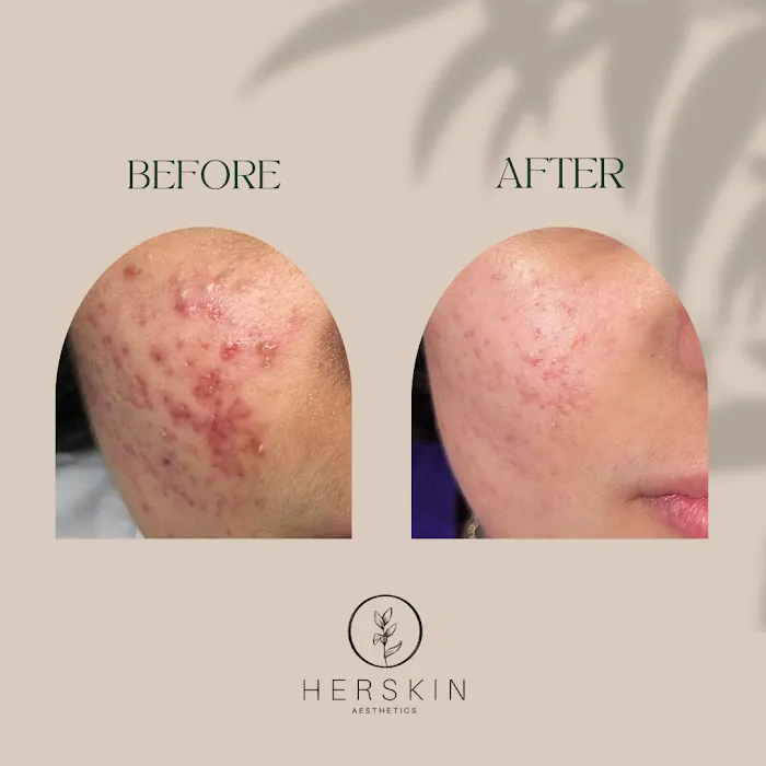 Herskin Aesthetics Picture 9