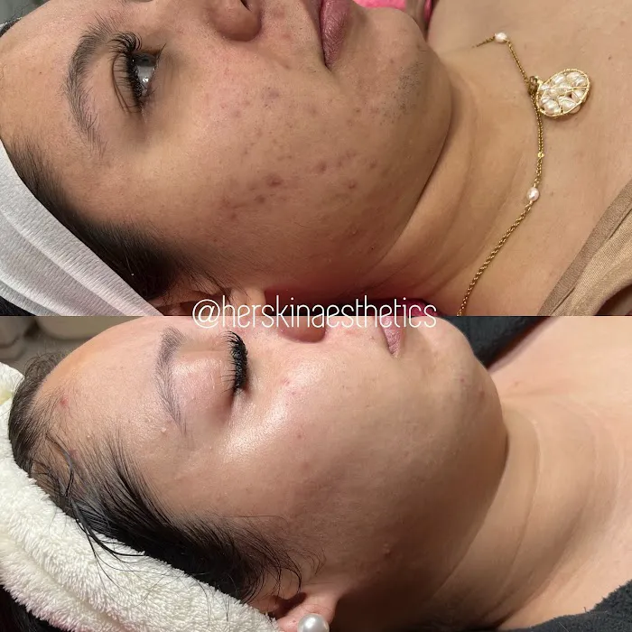 Herskin Aesthetics Picture 10