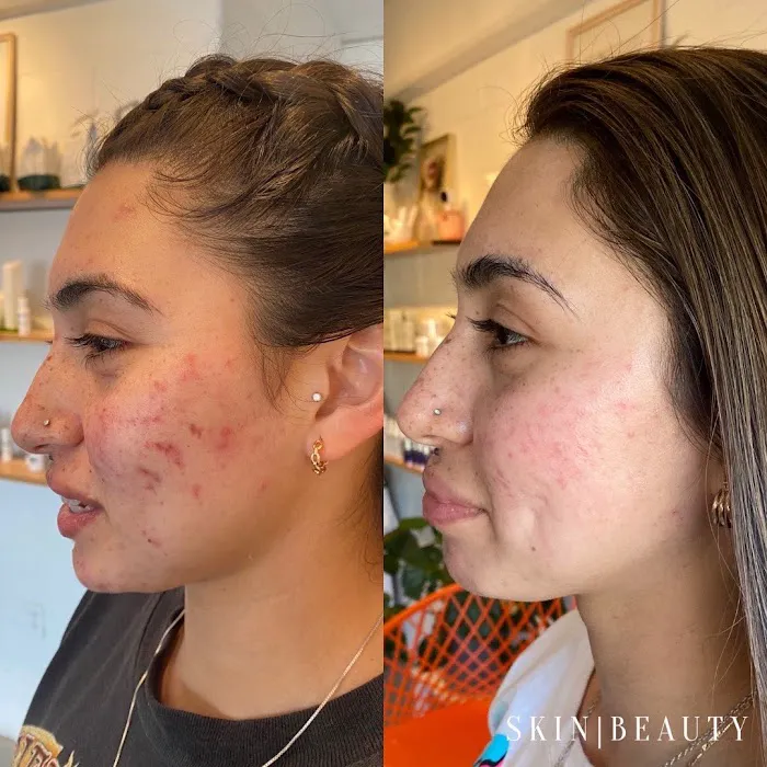 Skin Beauty Med Spa Picture 9