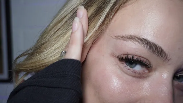 1st Impression Esthetic Picture 4