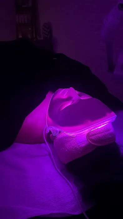 1st Impression Esthetic Picture 3