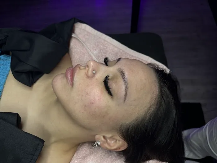 1st Impression Esthetic Picture 2