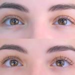 Dermaculture Skin Care Fort Worth