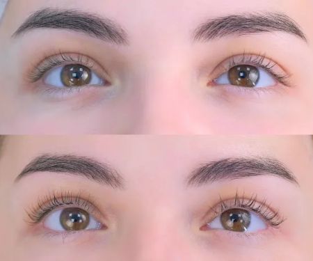 Dermaculture Skin Care Fort Worth