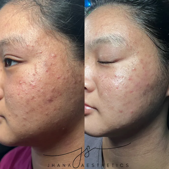 Jhana Aesthetics Picture 10