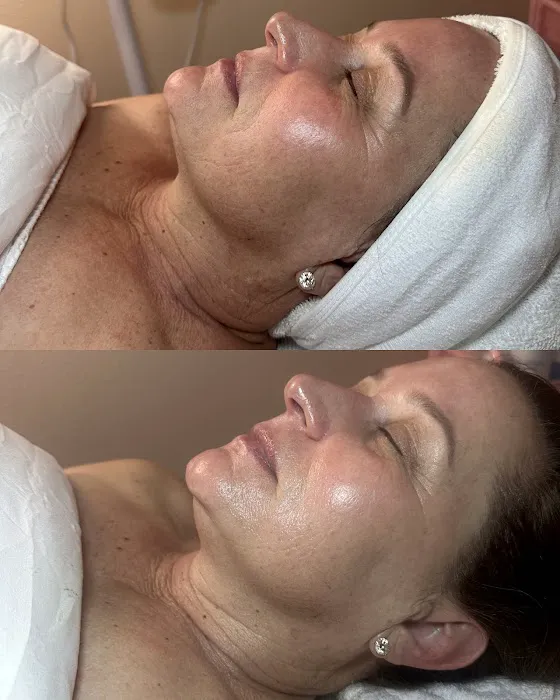 Face Integrity Picture 5