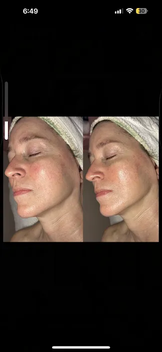 Face Integrity Picture 3