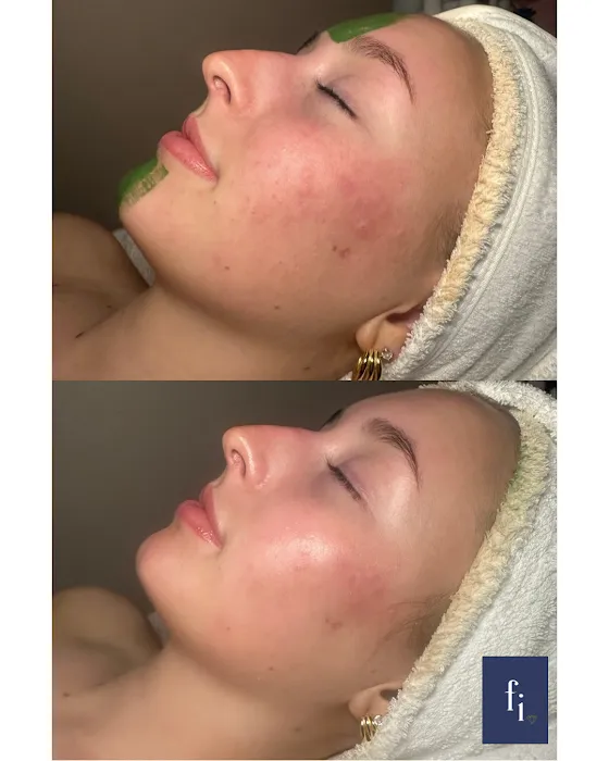 Face Integrity Picture 4