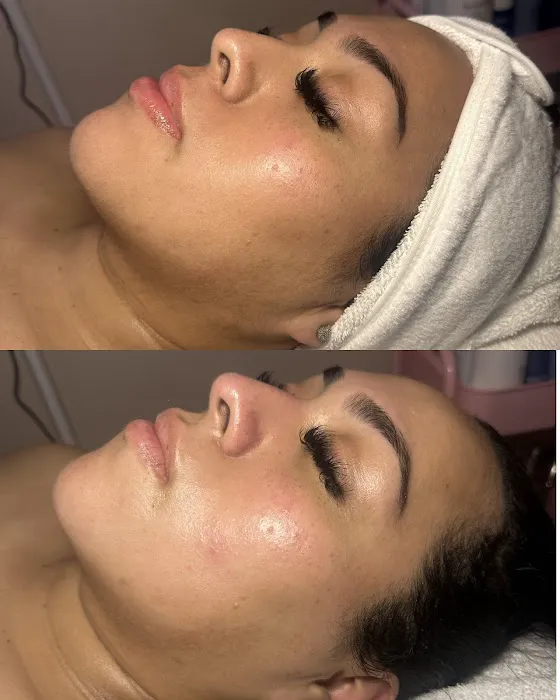 Face Integrity Picture 2