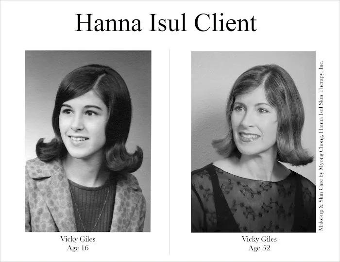 Hanna Isul Skin Therapy Picture 4