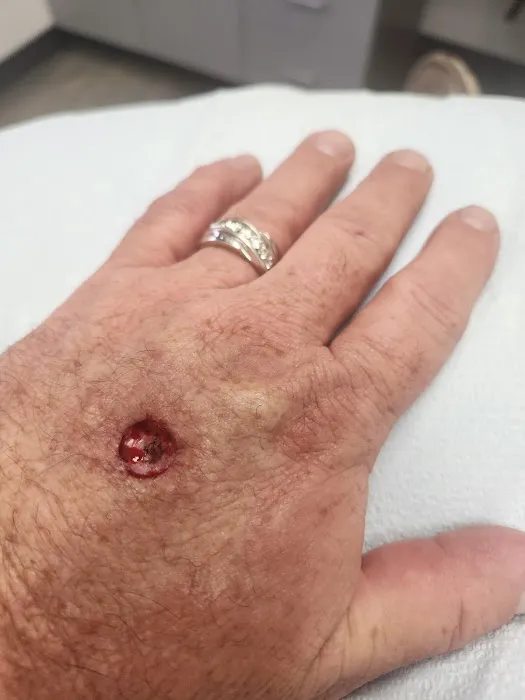 Mira Vista Surgical Dermatology - Fort Worth Picture 6