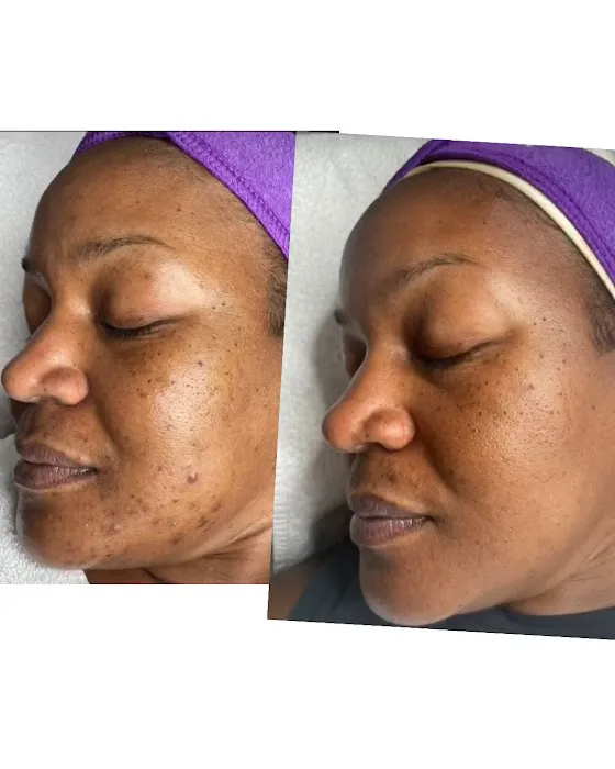 Unblemished Skin Studio Picture 4