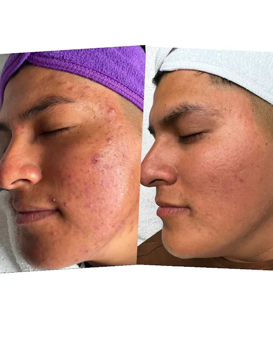 Unblemished Skin Studio Picture 3