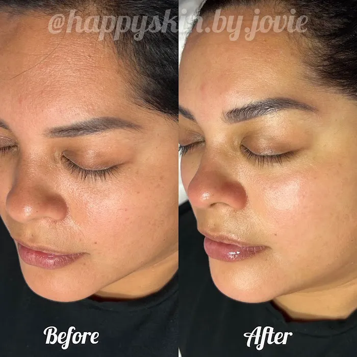 Happy Skin by Jovie Picture 2