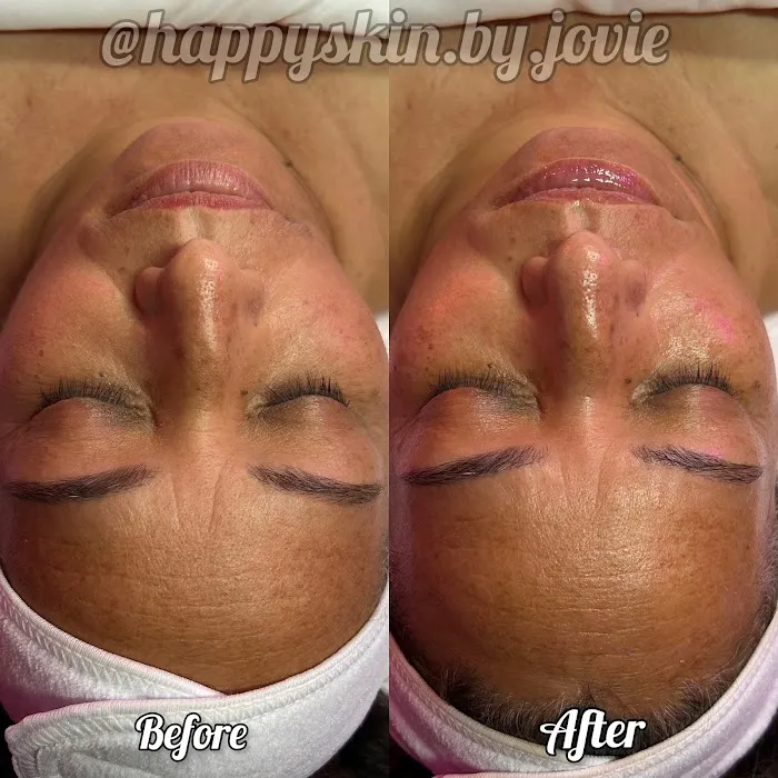 Happy Skin by Jovie Picture 1