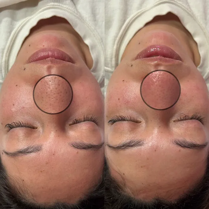 Happy Skin by Jovie Picture 7