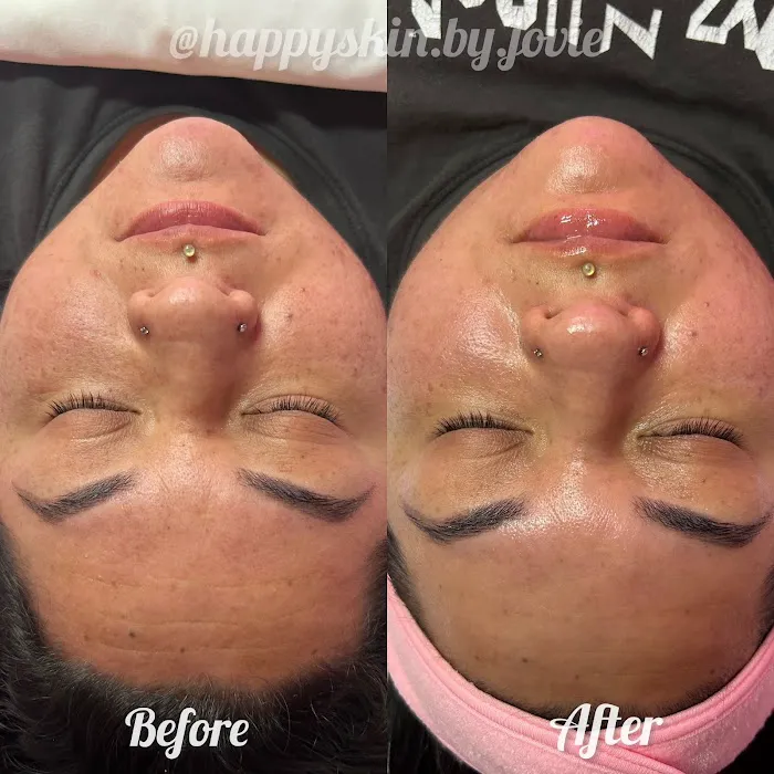 Happy Skin by Jovie Picture 8