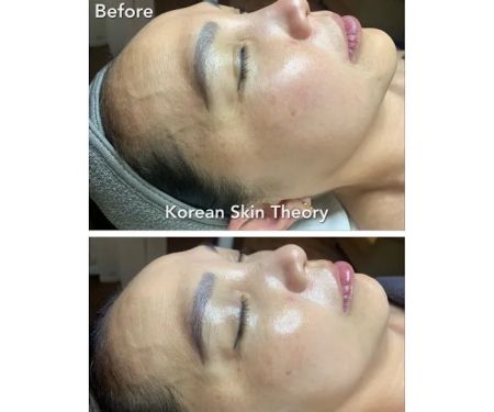Korean Skin Theory