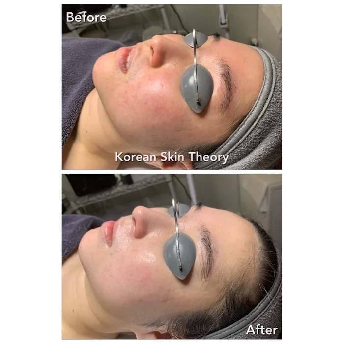 Korean Skin Theory Picture 2