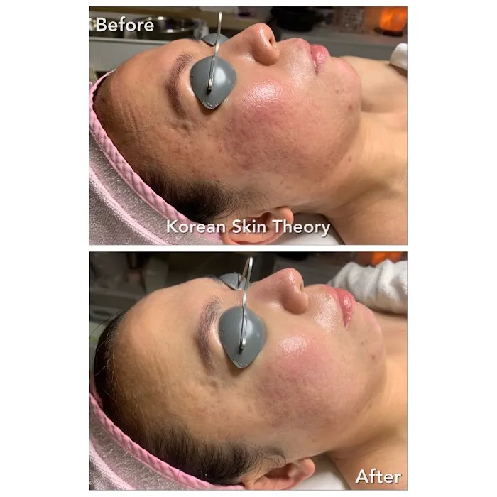 Korean Skin Theory Picture 4