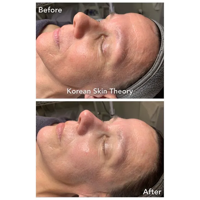 Korean Skin Theory Picture 5