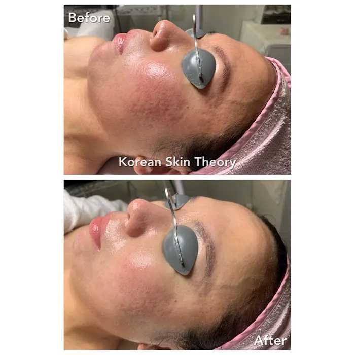 Korean Skin Theory Picture 3