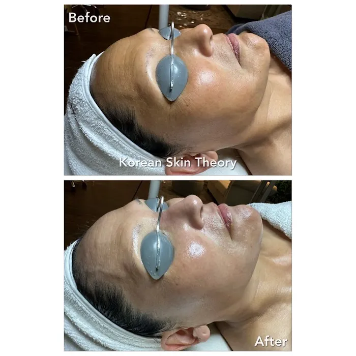 Korean Skin Theory Picture 10