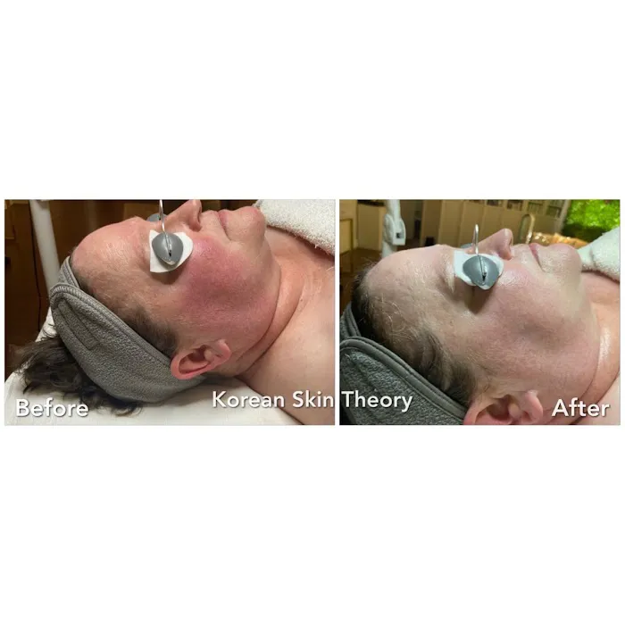 Korean Skin Theory Picture 9