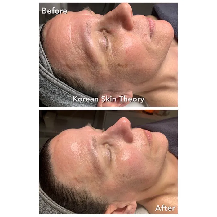 Korean Skin Theory Picture 6